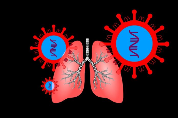 Coronavirus Infection