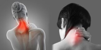 Cervical Pain