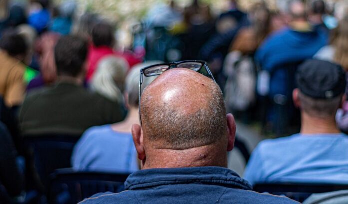 Premature Baldness